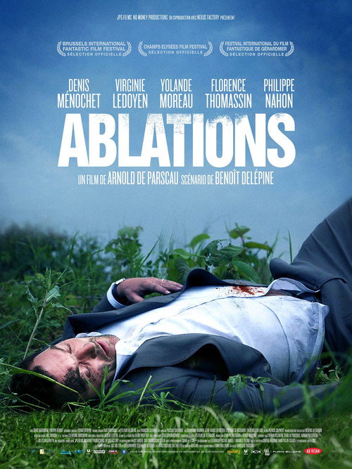 Locandina di Ablations