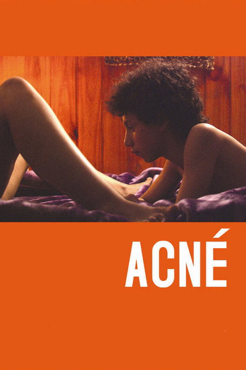 Póster de Acné